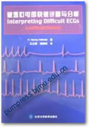 疑难心电图快速诊断与分析