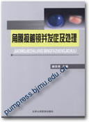 角膜接触镜并发症及处理