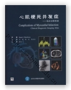心肌梗死并发症——临床诊断图谱