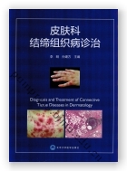 皮肤科结缔组织病诊治