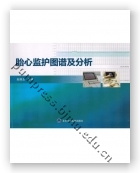 胎心监护图谱及分析
