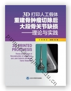 3D打印人工假体重建骨肿瘤切除后大段骨关节缺损——理论与实践