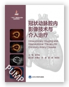 冠状动脉腔内影像技术与介入治疗