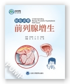 轻松读懂前列腺增生